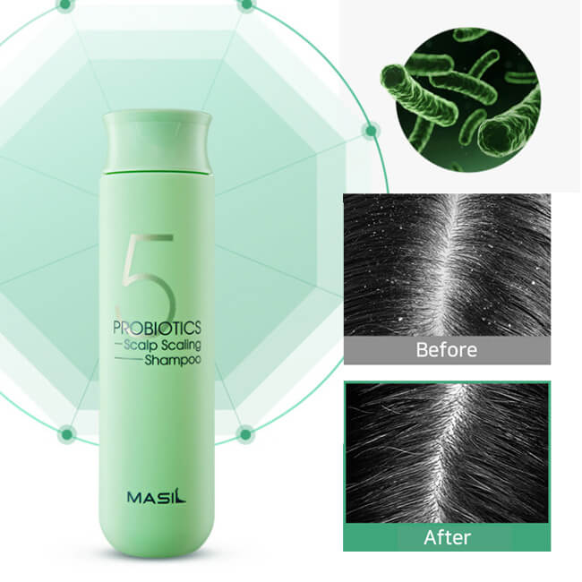 5 Probiotics Scalp Scaling Shampoo [Masil] (1)