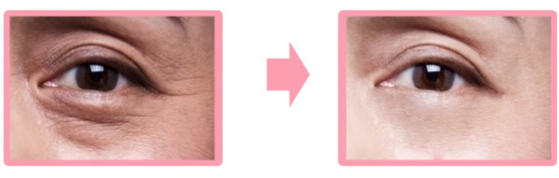 CU Skin Dr. Solution Capsule Tone-Up Eye Cream. (1)