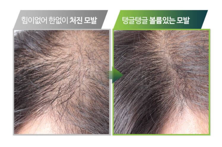 Hair tonic Aroma Green Hair Loss.... (1)