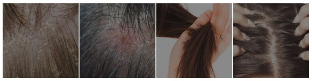 Lador Dermatical Hair-Loss Shampoo.
