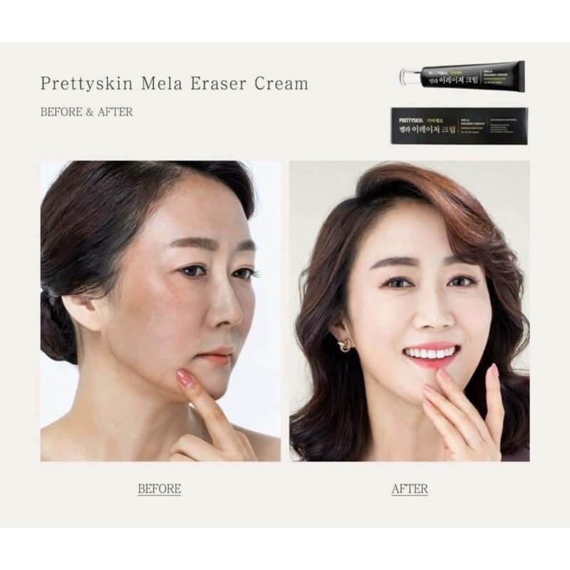 Mela Eraser Cream [Prettyskin (1)