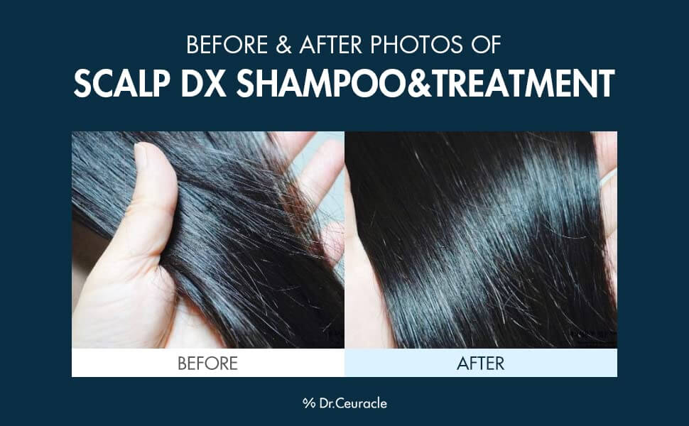 Scalp DX Scaling Shampoo [Dr.Ceuracle (1)