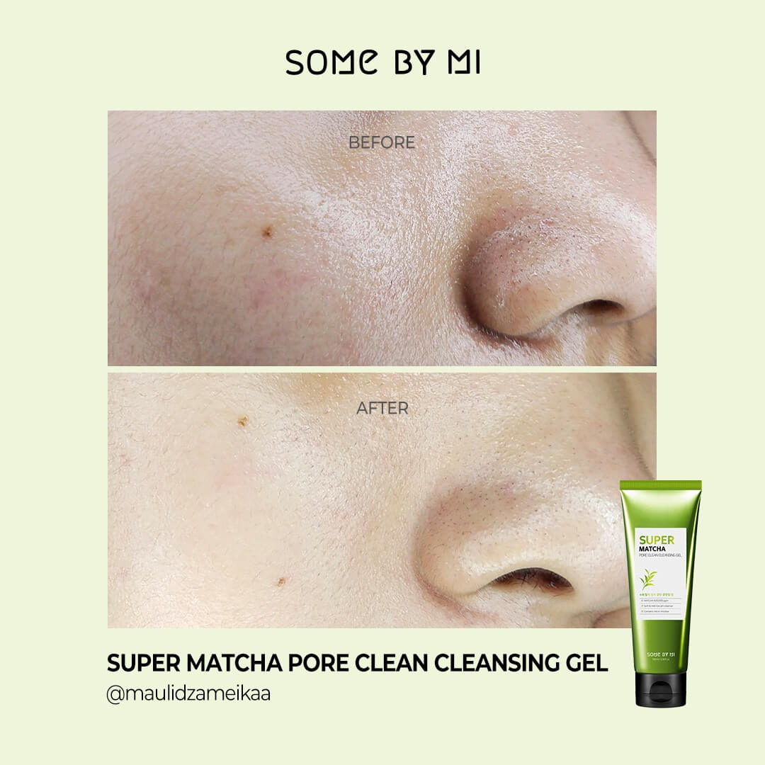 Some By Mi Super Matcha Pore Clean Cleansing Gel до и после (1)