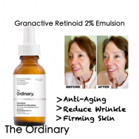Granactive Retinoid 2% Emulsion [The Ordinary]
