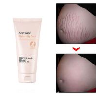 Maternity Care Stretch Mark Cream [Atopalm]